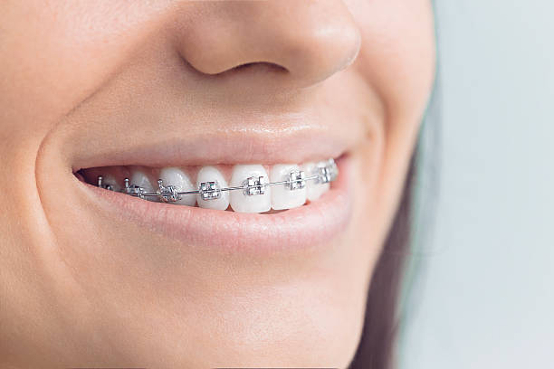 Best Full Mouth Reconstruction  in Edgewater, FL
